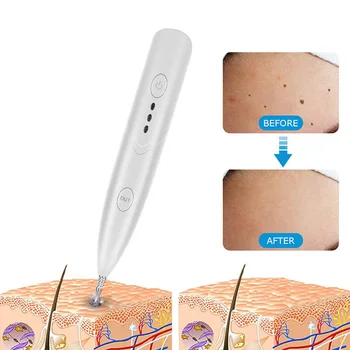 Mini Freckle Pero Tatoo Lasersko Odstranjevanje Kože Oznako Temno Spot Remover Obraz, Telo Čistilo Wart Odstranjevanje Lepoto Plazme Pero Poklicno